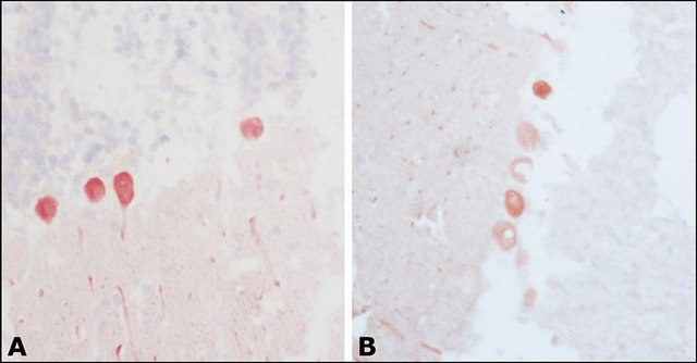 Anti-Calbindin-D-28K antibody, Mouse monoclonal clone CB-955, purified from hybridoma cell culture