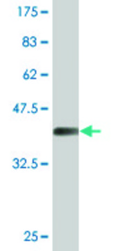 Monoclonal Anti-LAD1, (C-terminal) antibody produced in mouse clone 2A9, purified immunoglobulin, buffered aqueous solution