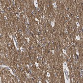 Anti-SEPT4 antibody produced in rabbit Prestige Antibodies® Powered by Atlas Antibodies, affinity isolated antibody, buffered aqueous glycerol solution, Ab1