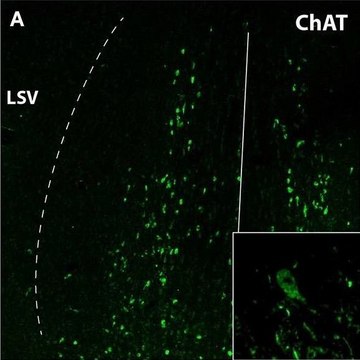 Anti-Choline Acetyltransferase Antibody serum, Chemicon&#174;