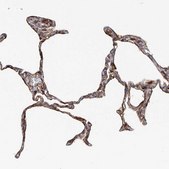 Anti-PIEZO2 antibody produced in rabbit Prestige Antibodies® Powered by Atlas Antibodies, affinity isolated antibody, buffered aqueous glycerol solution
