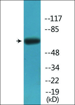 Anti-phospho-Fyn (pTyr530) antibody produced in rabbit affinity isolated antibody