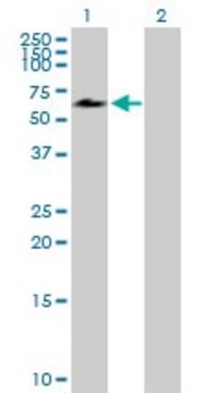 Anti-ACD antibody produced in mouse purified immunoglobulin, buffered aqueous solution