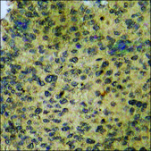 Anti-phospho-IKK-β (pTyr199) antibody produced in rabbit affinity isolated antibody