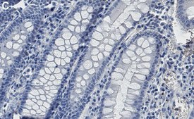 Anti-γ Catenin Antibody, clone 1H22 ZooMAb® Rabbit Monoclonal recombinant, expressed in HEK 293 cells