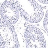 Monoclonal Anti-CALB1 antibody produced in mouse Prestige Antibodies® Powered by Atlas Antibodies, clone CL15059, purified antibody (Protein A)