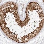 Anti-NUDC antibody produced in rabbit Prestige Antibodies® Powered by Atlas Antibodies, affinity isolated antibody, buffered aqueous glycerol solution, ab2