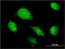 Monoclonal Anti-AMBP antibody produced in mouse clone 3F1, purified immunoglobulin, buffered aqueous solution