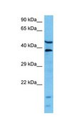 Anti-LARP6 antibody produced in rabbit affinity isolated antibody