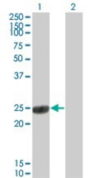 Monoclonal Anti-COMT antibody produced in mouse clone 1G4-1A1, purified immunoglobulin, buffered aqueous solution