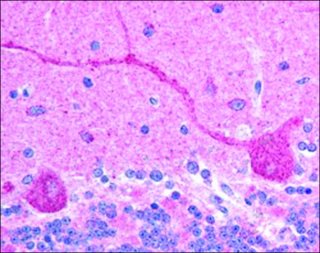 Anti-CHFR antibody produced in goat affinity isolated antibody, buffered aqueous solution