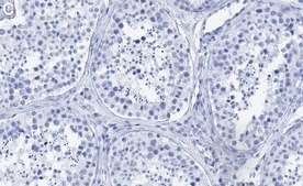 Anti-Geminin Antibody, clone 1K11 ZooMAb® Rabbit Monoclonal recombinant, expressed in HEK 293 cells