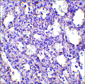 Anti-STIM2 (ab2) antibody produced in rabbit affinity isolated antibody, buffered aqueous solution