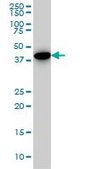 Monoclonal Anti-CNOT2, (C-terminal) antibody produced in mouse clone 3F1, ascites fluid