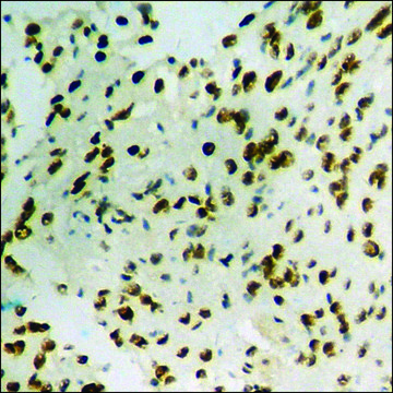 抗-磷酸化-SSB (pSer366) 兔抗 affinity isolated antibody