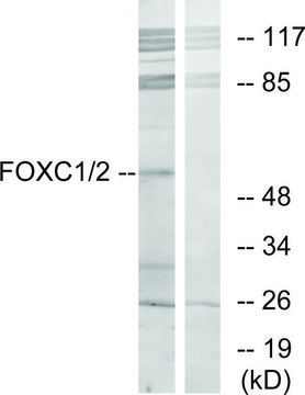 Anti-FOXC1 antibody produced in rabbit affinity isolated antibody