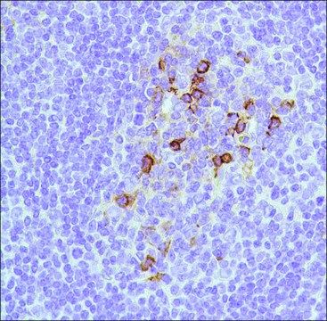 Anti-CD138 antibody, Rabbit monoclonal recombinant, expressed in proprietary host, clone SP152, affinity isolated antibody