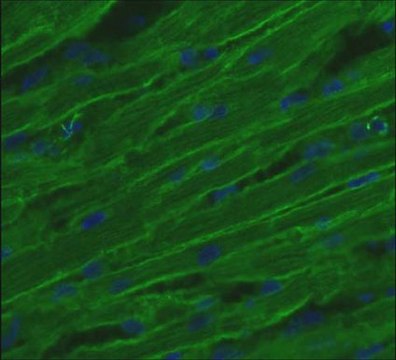 Anti-Integrin &#946;1D Antibody, CT cytoplasmic domain, clone 2B1 clone 2B1, Chemicon&#174;, from mouse