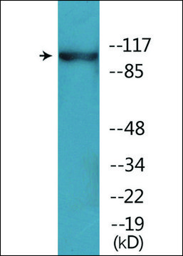 Anti-phospho-ACK1 (pTyr284) antibody produced in rabbit affinity isolated antibody