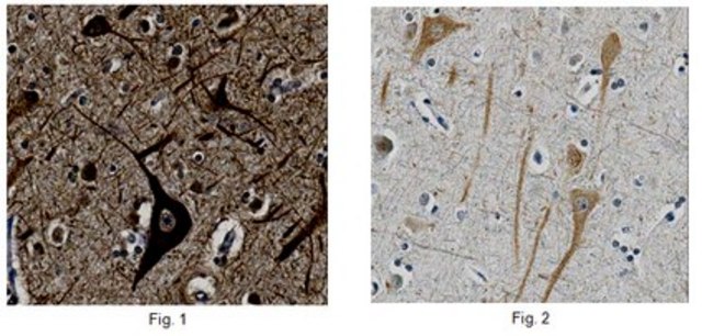 Anti-Capicua Antibody from rabbit, purified by affinity chromatography