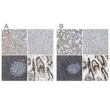 抗-SP100 兔抗 Prestige Antibodies&#174; Powered by Atlas Antibodies, affinity isolated antibody, buffered aqueous glycerol solution