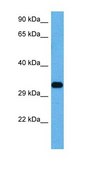 Anti-AQP4 antibody produced in rabbit affinity isolated antibody