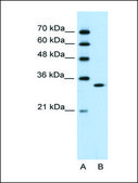 Anti-RNASEH2A antibody produced in rabbit affinity isolated antibody