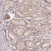 Anti-MMACHC antibody produced in rabbit Prestige Antibodies® Powered by Atlas Antibodies, affinity isolated antibody, buffered aqueous glycerol solution, ab1