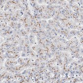 Anti-ABCC2 antibody produced in rabbit Prestige Antibodies® Powered by Atlas Antibodies, affinity isolated antibody, buffered aqueous glycerol solution, Ab2
