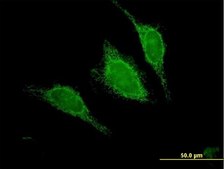Anti-ACADM antibody produced in mouse purified immunoglobulin, buffered aqueous solution