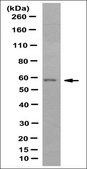 Anti-PFKFB3 Antibody, clone 4C10.2 clone 4C10.2, from mouse