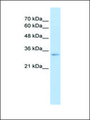 Anti-THOC4 antibody produced in rabbit IgG fraction of antiserum