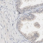 Anti-MAGEA8 antibody produced in rabbit Prestige Antibodies® Powered by Atlas Antibodies, affinity isolated antibody, buffered aqueous glycerol solution