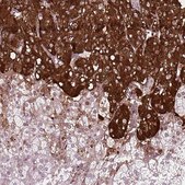 Anti-CHGB antibody produced in rabbit Prestige Antibodies® Powered by Atlas Antibodies, affinity isolated antibody, buffered aqueous glycerol solution