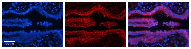 Anti-PDXK antibody produced in rabbit affinity isolated antibody