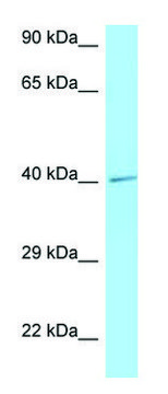 Anti-IL3RA (C-terminal) antibody produced in rabbit affinity isolated antibody