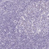 Anti-SLC13A1 antibody produced in rabbit Prestige Antibodies® Powered by Atlas Antibodies, affinity isolated antibody, buffered aqueous glycerol solution