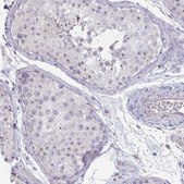 Anti-MYC antibody produced in rabbit Prestige Antibodies® Powered by Atlas Antibodies, affinity isolated antibody, buffered aqueous glycerol solution