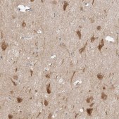 Anti-RERE antibody produced in rabbit Prestige Antibodies® Powered by Atlas Antibodies, affinity isolated antibody, buffered aqueous glycerol solution