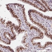 Anti-CD2BP2 antibody produced in rabbit Prestige Antibodies® Powered by Atlas Antibodies, affinity isolated antibody, buffered aqueous glycerol solution