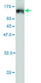 ANTI-TOP3B antibody produced in mouse clone 1H8, purified immunoglobulin, buffered aqueous solution