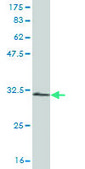 Monoclonal Anti-RPS28 antibody produced in mouse clone 2F9, purified immunoglobulin, buffered aqueous solution