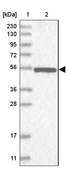 Anti-NPEPL1 antibody produced in rabbit Prestige Antibodies® Powered by Atlas Antibodies, affinity isolated antibody, buffered aqueous glycerol solution