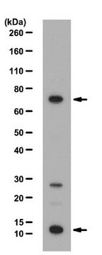 Anti-PRDM5 Antibody from rabbit, purified by affinity chromatography