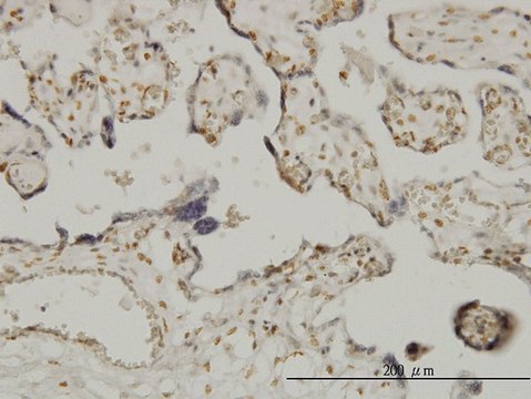 Monoclonal Anti-ETV6 antibody produced in mouse clone 3B10, purified immunoglobulin, buffered aqueous solution