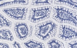 Anti-γ-Actin Antibody, clone 6J13 ZooMAb® Rabbit Monoclonal recombinant, expressed in HEK 293 cells