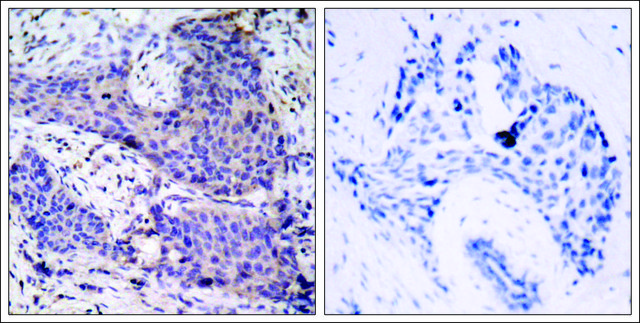 Anti-BAD (Ab-136) antibody produced in rabbit affinity isolated antibody