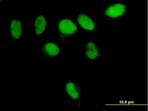 Anti-PARG antibody produced in mouse IgG fraction of antiserum, buffered aqueous solution