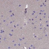 Anti-AMDHD2 antibody produced in rabbit Prestige Antibodies® Powered by Atlas Antibodies, affinity isolated antibody, buffered aqueous glycerol solution