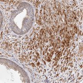 Anti-GBP4 antibody produced in rabbit Prestige Antibodies® Powered by Atlas Antibodies, affinity isolated antibody, buffered aqueous glycerol solution